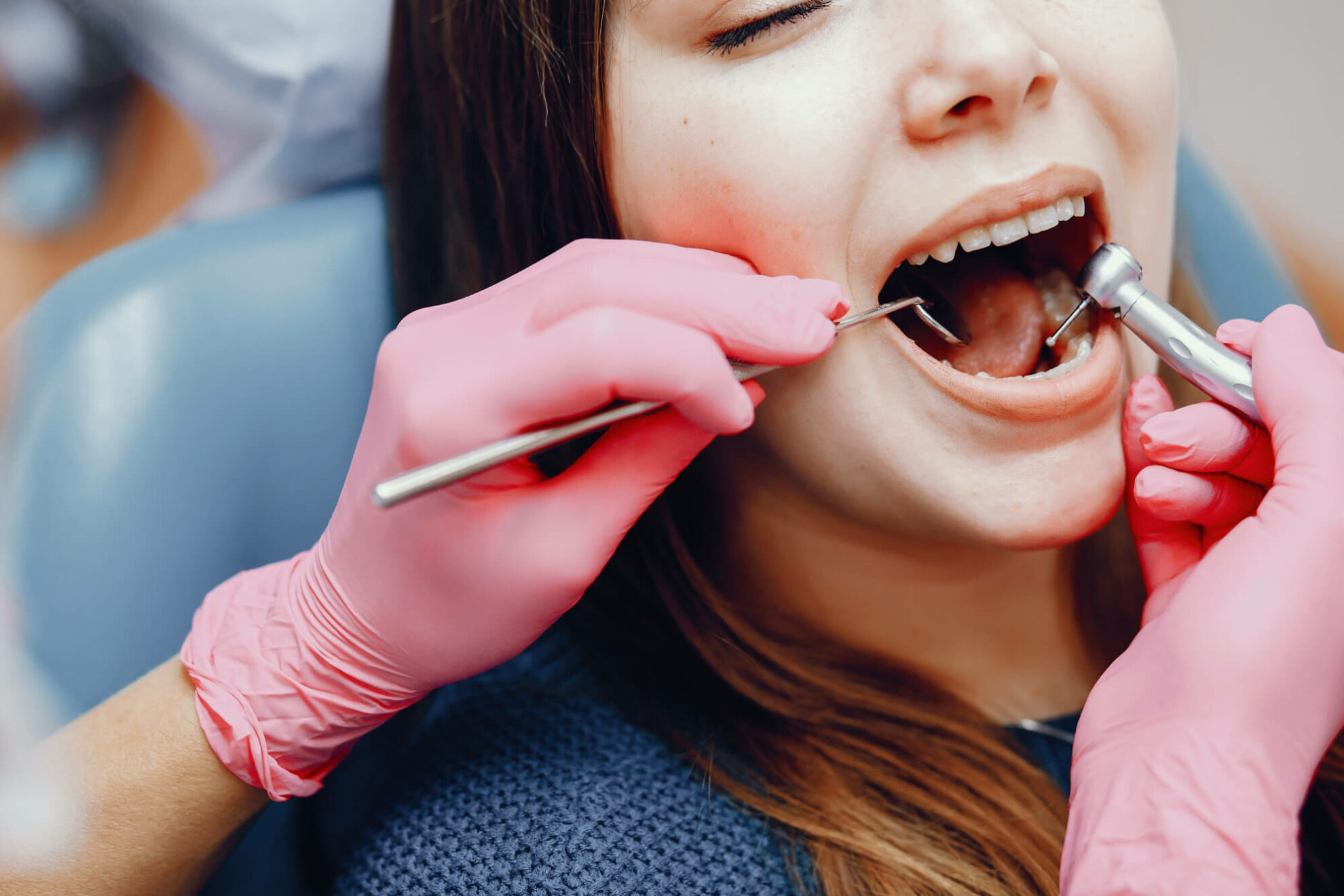 How Much Do Dental Sealants Cost Smile Marysville