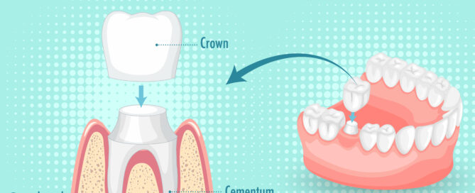 24554284 lg47 vgig 220301