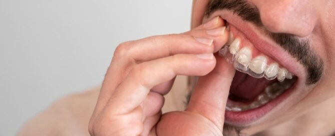 how to stop my invisalign from cutting my gums