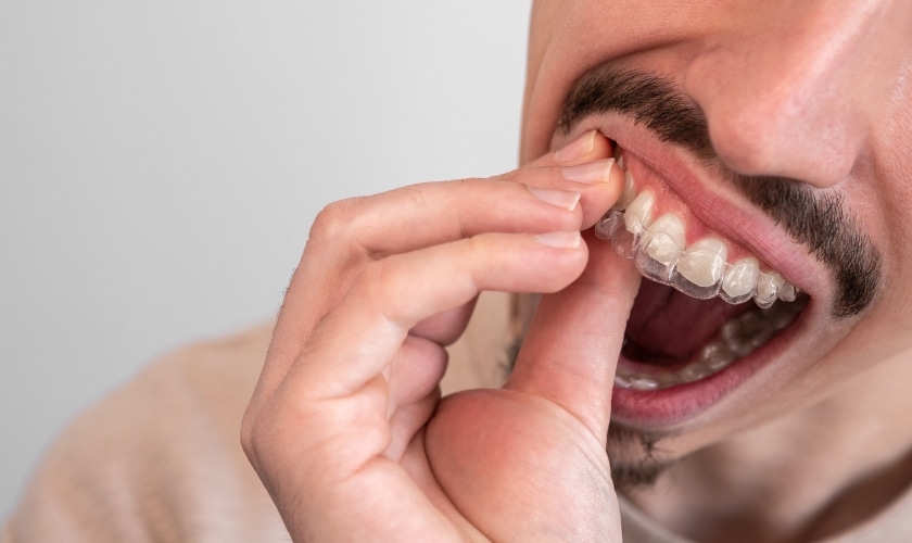 when can i brush my teeth after tooth extraction?