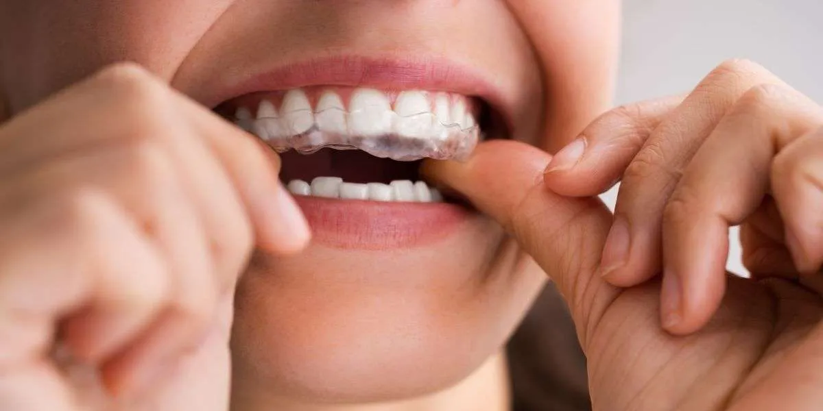 Maintaining Your Clear Aligner Routine During Busy Fall Activities