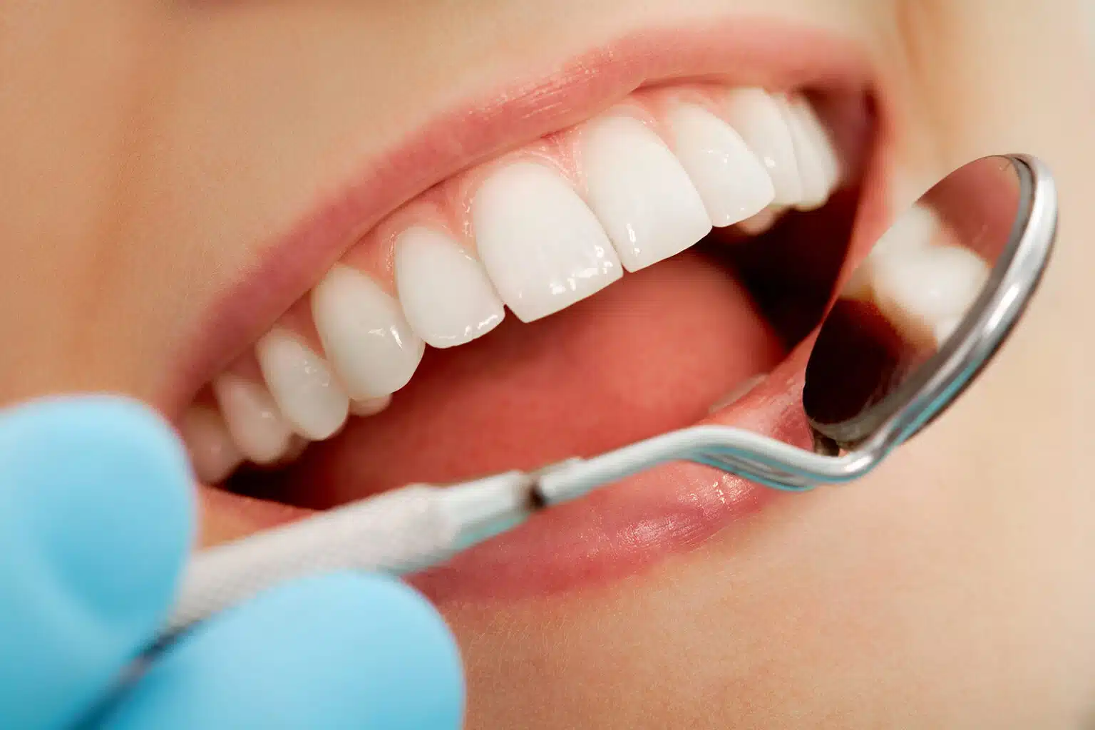 Most Popular Cosmetic Dental Procedures | Smile Marysville Dentist Treatment